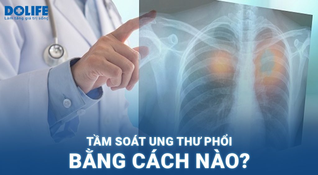 Tầm soát ung thư phổi bằng cách nào?