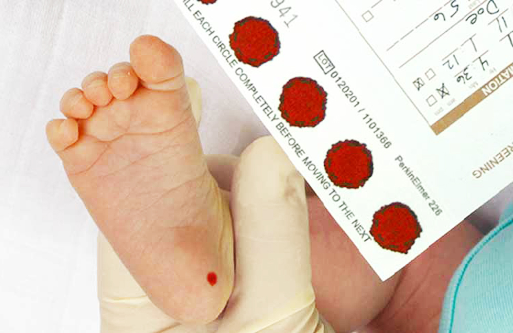 Sàng lọc sơ sinh lấy máu gót chân là phương pháp phát hiện và điều trị sớm những loại bệnh bẩm sinh về nội tiết, rối loạn chuyển hóa, di truyền ngay từ thời điểm trẻ được sinh ra.