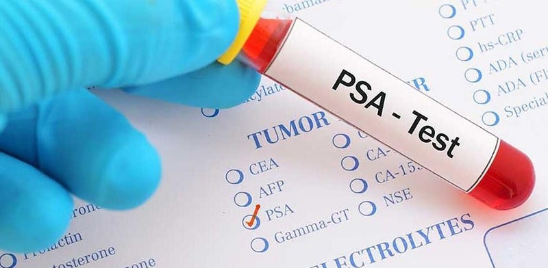 Xét nghiệm máu PSA dành cho những trường hợp không có dấu hiệu cụ thể