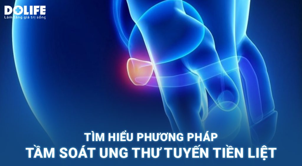 Tầm soát ung thư tuyến tiền liệt là gì?