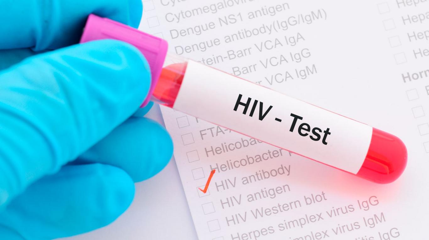 Xét nghiệm HIV là một danh mục không bắt buộc khi khám sức khỏe doanh nghiệp