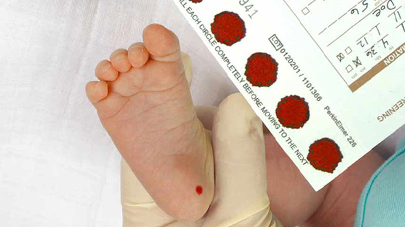 Lấy máu gót chân sơ sinh giúp phát hiện nhiều bệnh lý nguy hiểm