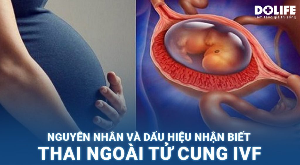 Nguyên nhân và các dấu hiệu nhận biết thai ngoài tử cung IVF