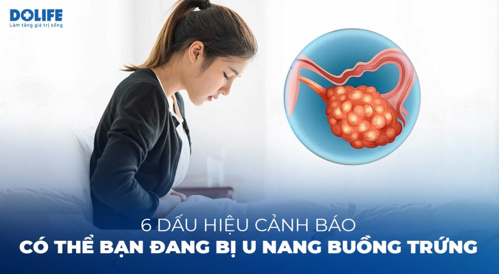Cẩn trọng với các dấu hiệu của u nang buồng trứng – Bạn có đang bỏ qua?