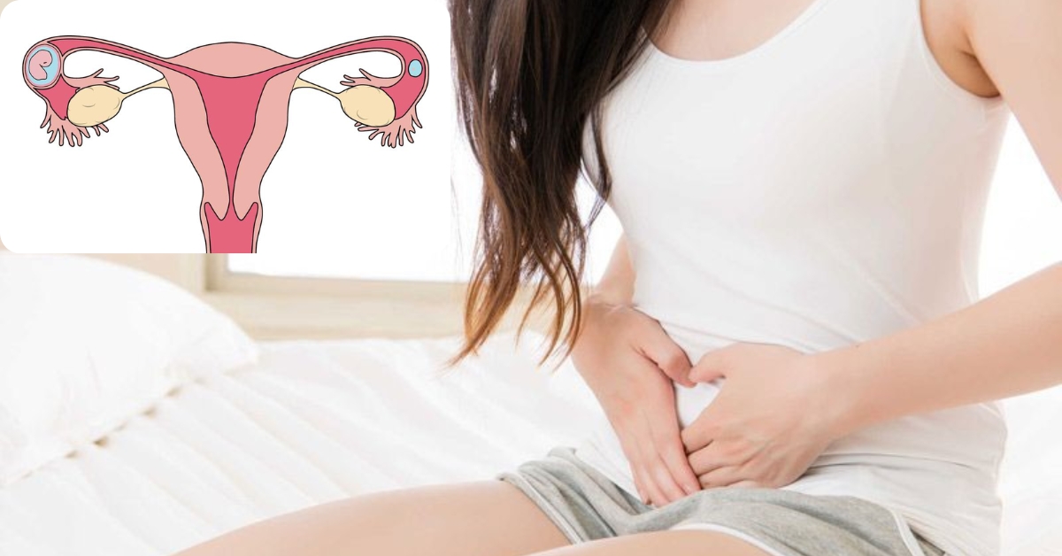 Đau nhức vùng chậu là một triệu chứng mang thai ngoài tử cung
