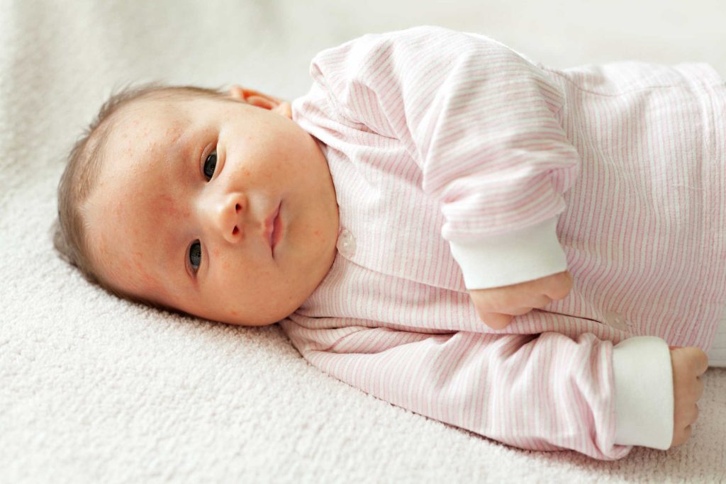 Nhiễm khuẩn đường ruột ở trẻ sơ sinh là một trong những tác nhân gây ảnh hưởng nặng nề đến hệ tiêu hóa của trẻ