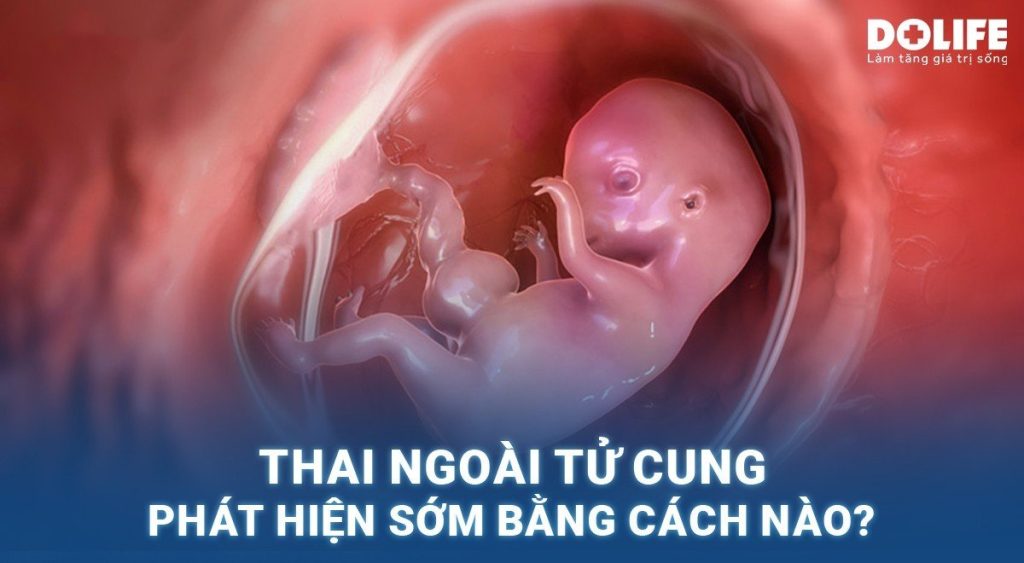 Thai ngoài tử cung phát hiện sớm bằng cách nào?