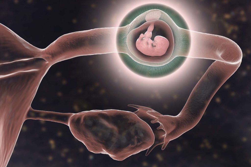 Thai ngoài tử cung là hiện tượng thai không làm tổ ở trong buồng tử cung mà có thể làm tổ ở những vị trí khác như: Vòi trứng, cổ tử cung hay ổ bụng.
