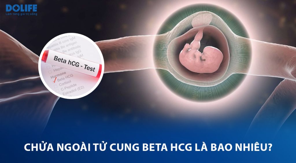 Chỉ số Beta HCG mang thai ngoài tử cung là bao nhiêu?