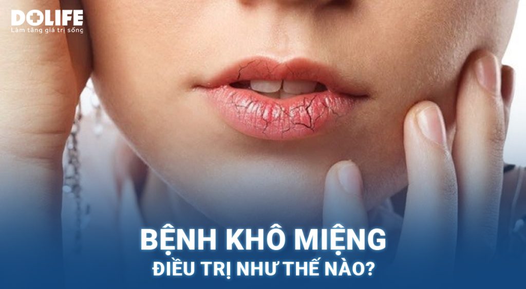 Khô miệng: Nguyên nhân, triệu chứng và cách điều trị