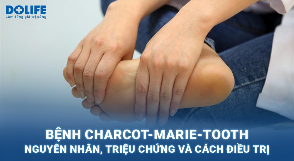Bệnh Charcot-Marie-Tooth: Nguyên nhân, triệu chứng và cách điều trị