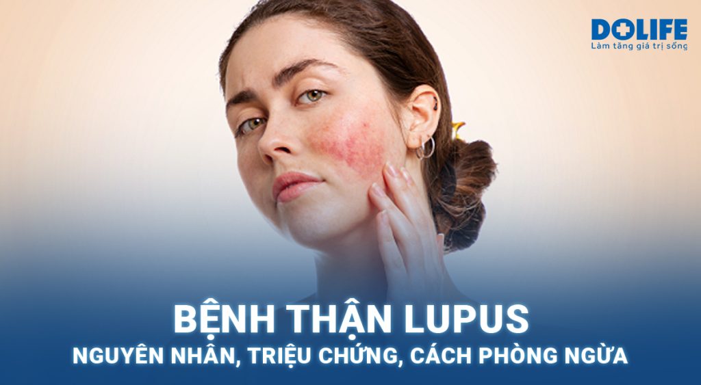 Bệnh thận Lupus: Nguyên nhân, triệu chứng và cách điều trị