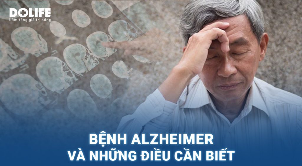 Alzheimer: Nguyên nhân, triệu chứng và biện pháp điều trị