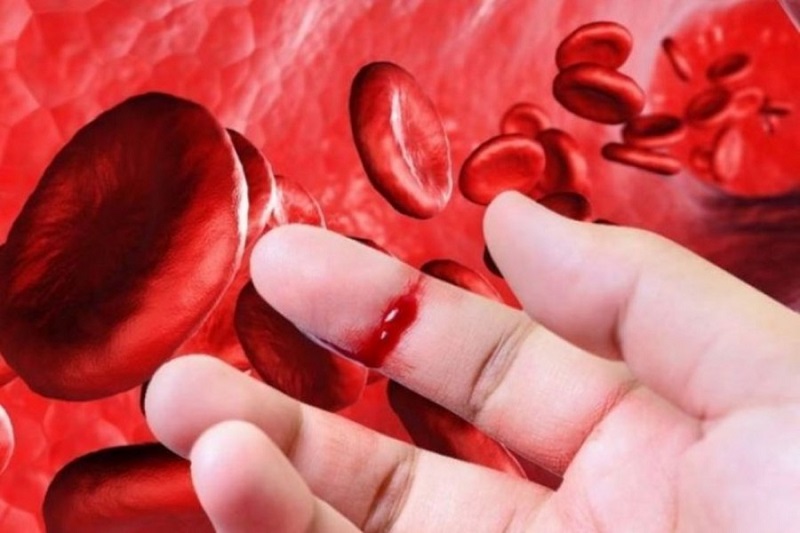 Chảy máu lâu cầm là hiện tượng quá trình đông máu diễn ra không theo sinh lý bình thường, có thể là do thiếu hụt về tiểu cầu hay các yếu tố đông máu