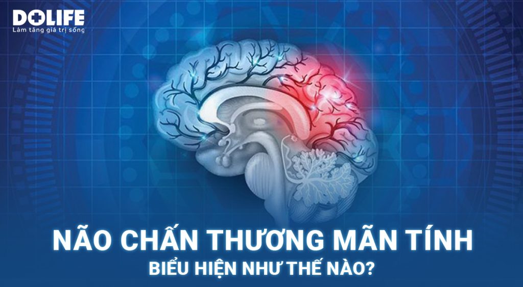 Não chấn thương mãn tính: Nguyên nhân và cách điều trị