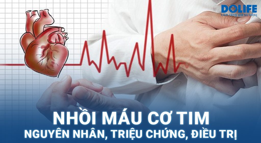 Nhồi máu cơ tim: Nguyên nhân, dấu hiệu và cách phòng ngừa