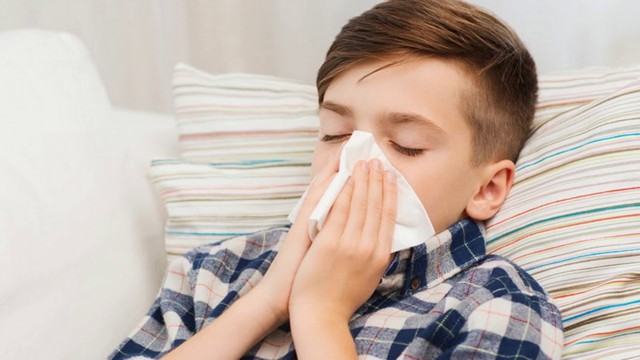 Cúm mùa là một nhiễm virus cấp tính tuýp A, B hoặc C gây ra.