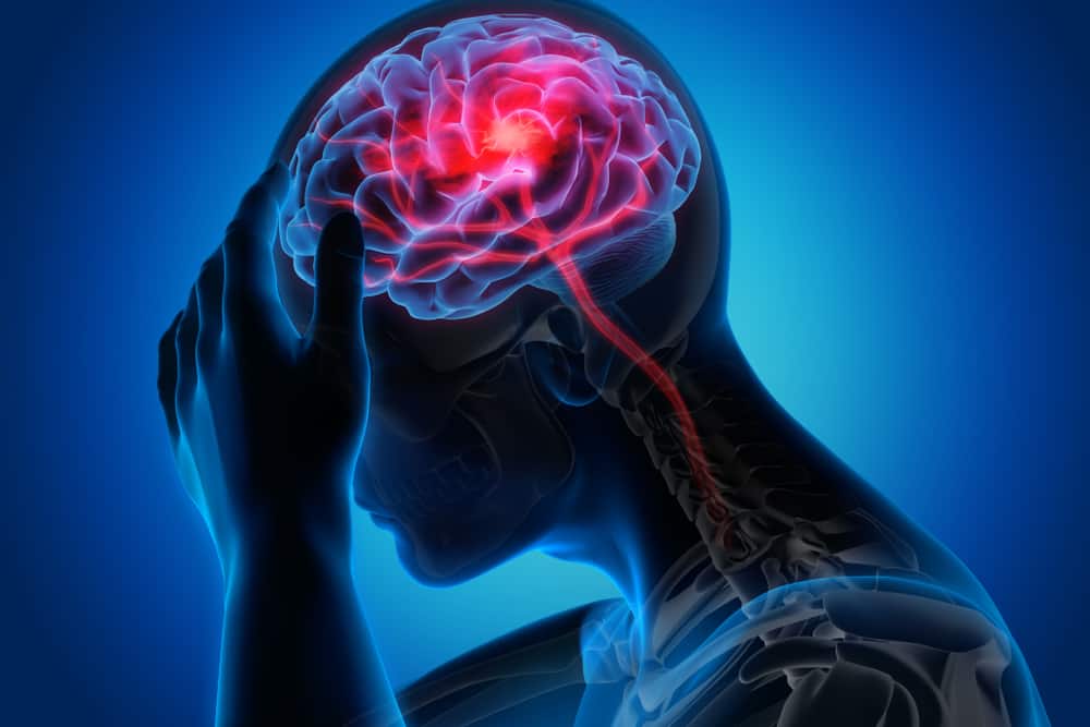 Động kinh thùy thái dương là một dạng động kinh đặc biệt, gây ảnh hưởng nghiêm trọng tới trí nhớ của người bệnh.