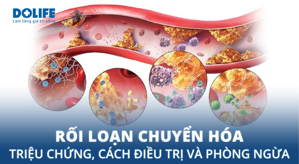 Rối loạn chuyển hóa: Triệu chứng, cách điều trị và phòng ngừa