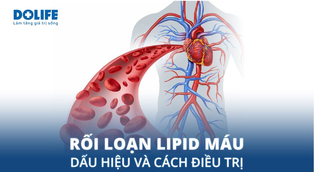 Rối loạn lipid máu: Dấu hiệu nhận biết và cách điều trị