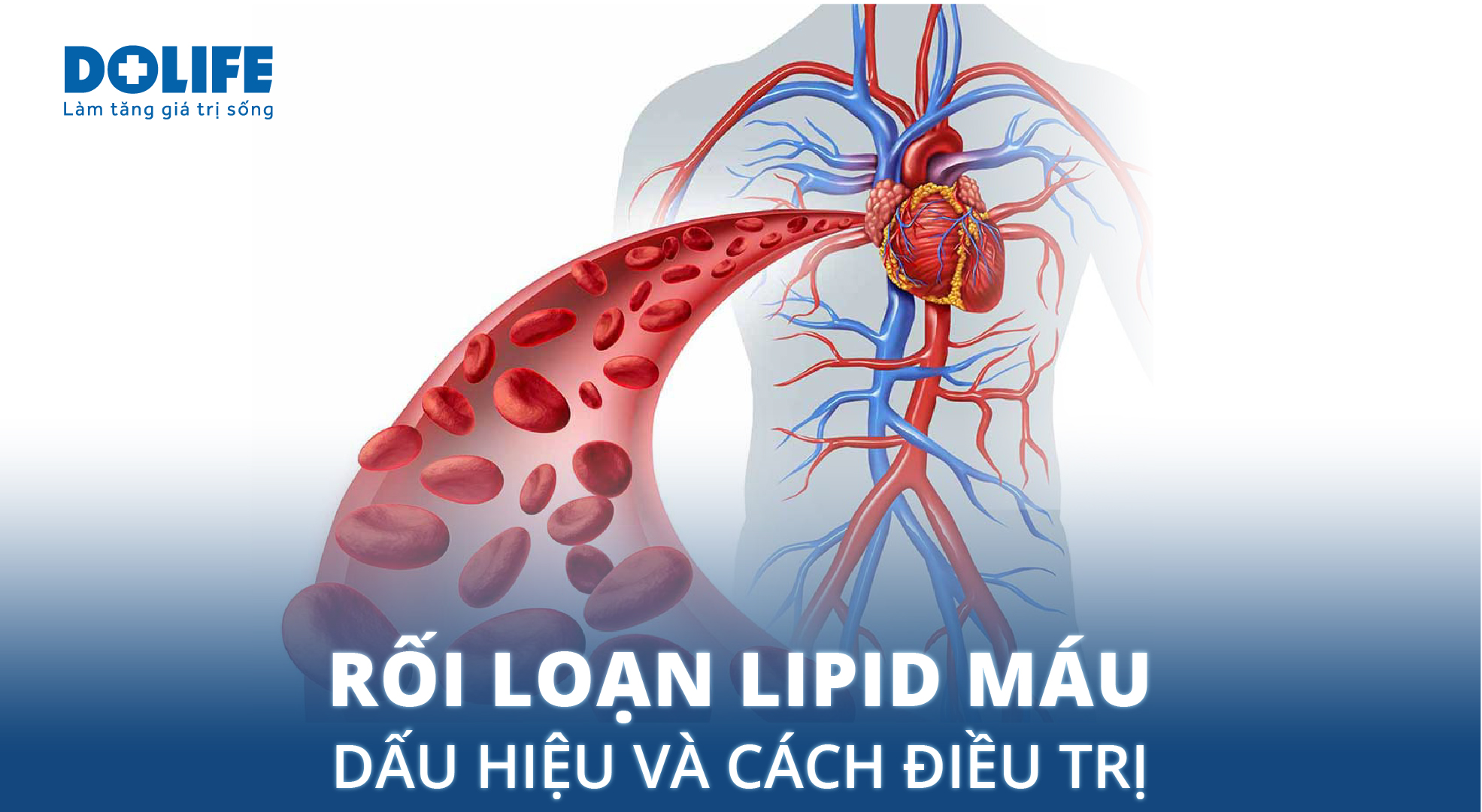 Thông tin chung về rối loạn lipid máu