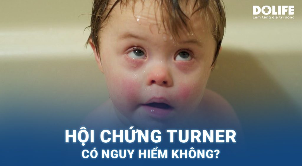 Hội chứng Turner có nguy hiểm không? Phương pháp điều trị hiệu quả