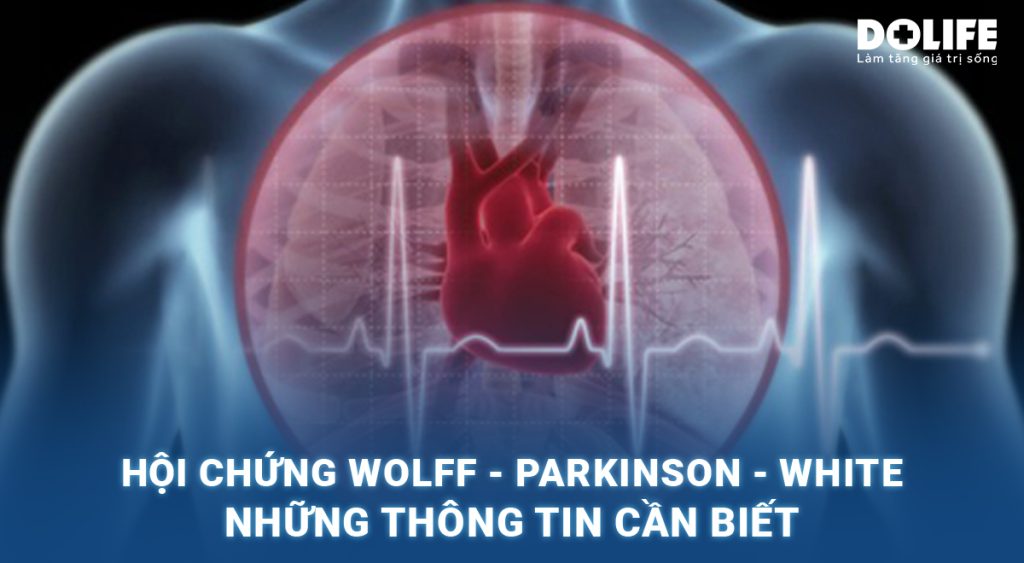 Hội chứng Wolff – Parkinson – White: Những thông tin cần biết