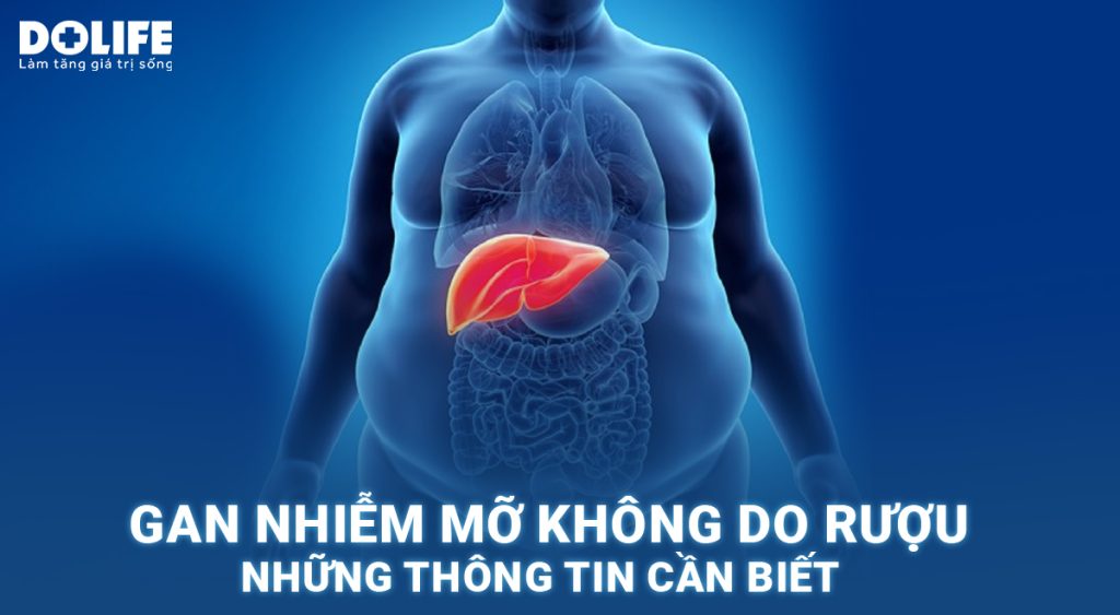 Gan nhiễm mỡ không do rượu: Nguyên nhân và phương pháp điều trị