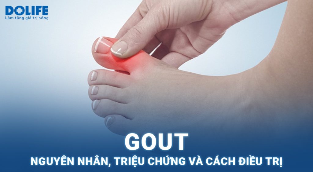 Gout: Nguyên nhân, triệu chứng và cách điều trị