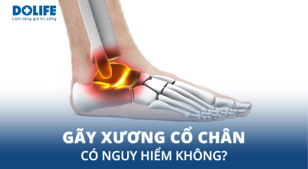 Gãy xương cổ chân: có nguy hiểm không? Phương pháp điều trị thế nào?
