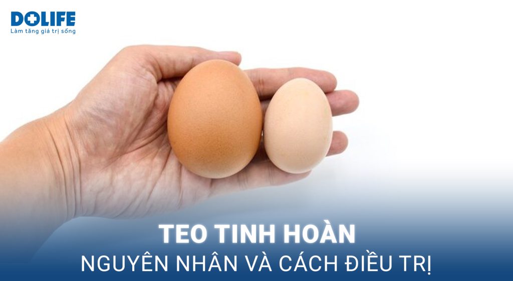 Teo tinh hoàn: Triệu chứng và cách điều trị