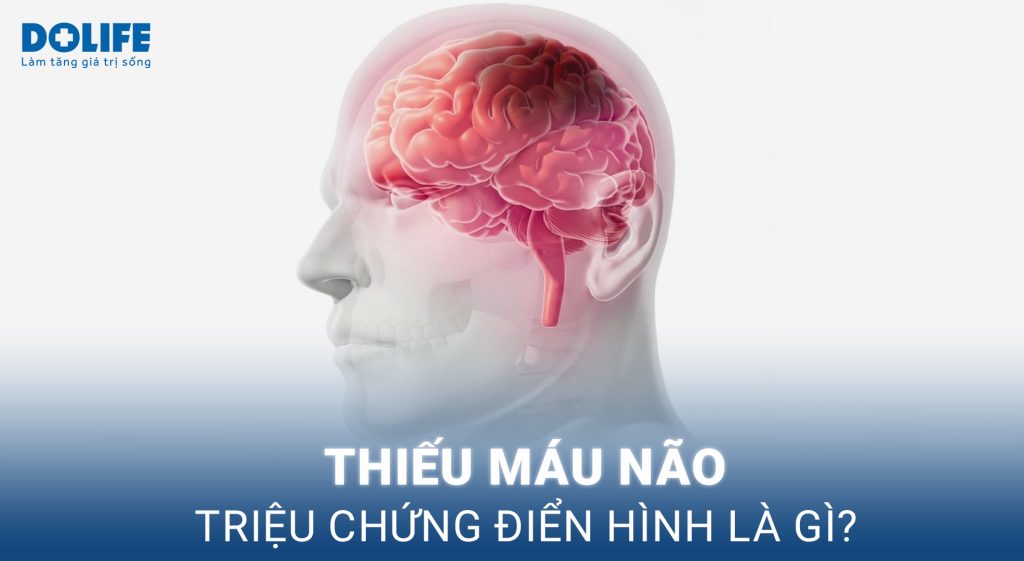 Thiếu máu não: Dấu hiệu, cách điều trị và phòng ngừa