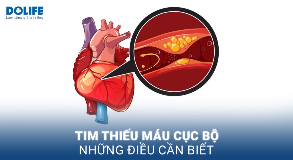 Tim thiếu máu cục bộ: Nhận biết ngay để tránh nguy cơ biến chứng