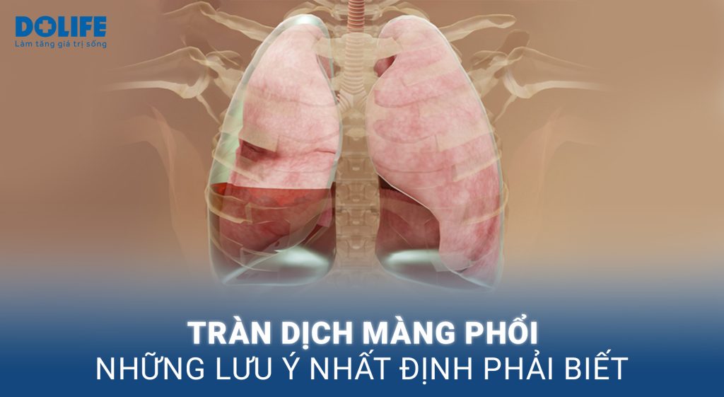 Tràn dịch màng phổi: Nguyên nhân, triệu chứng và cách điều trị