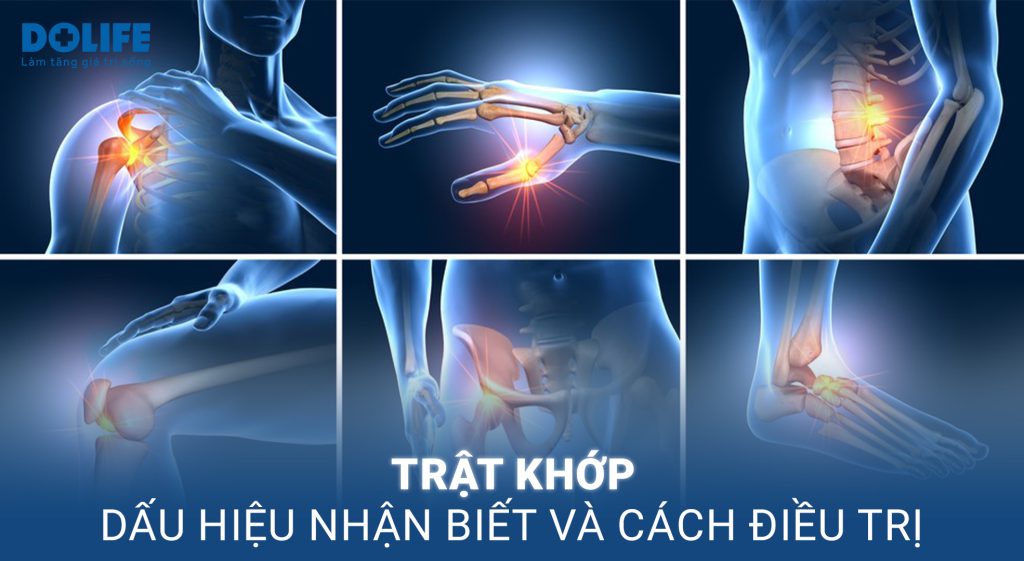 Trật khớp: Dấu hiệu nhận biết và cách điều trị