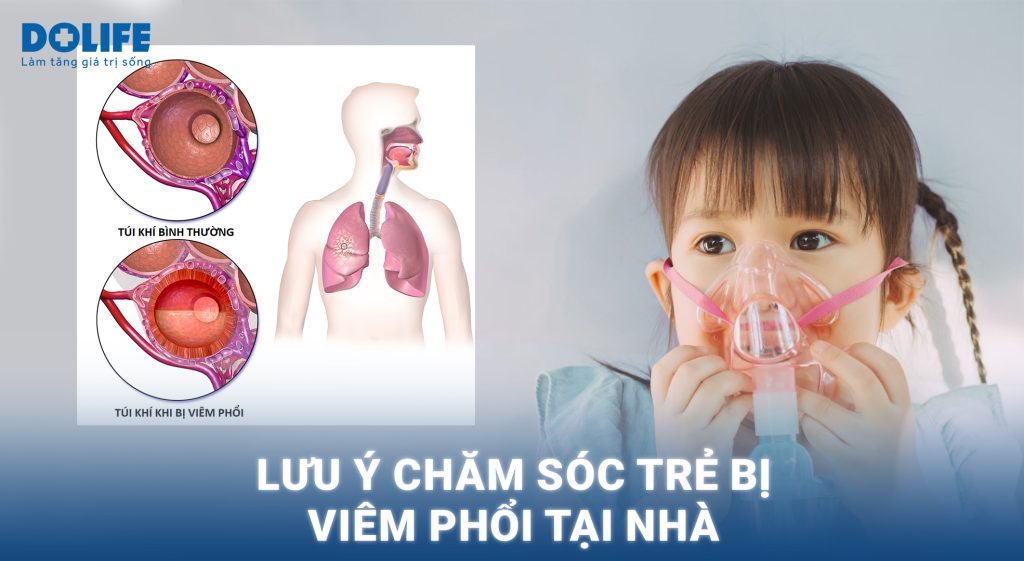 Chăm sóc trẻ bị viêm phổi tại nhà – Ba mẹ lưu ý ngay những điều này!