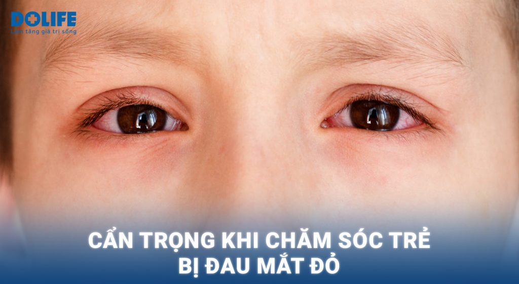 Đau mắt đỏ ở trẻ: Nguyên nhân, triệu chứng và cách điều trị