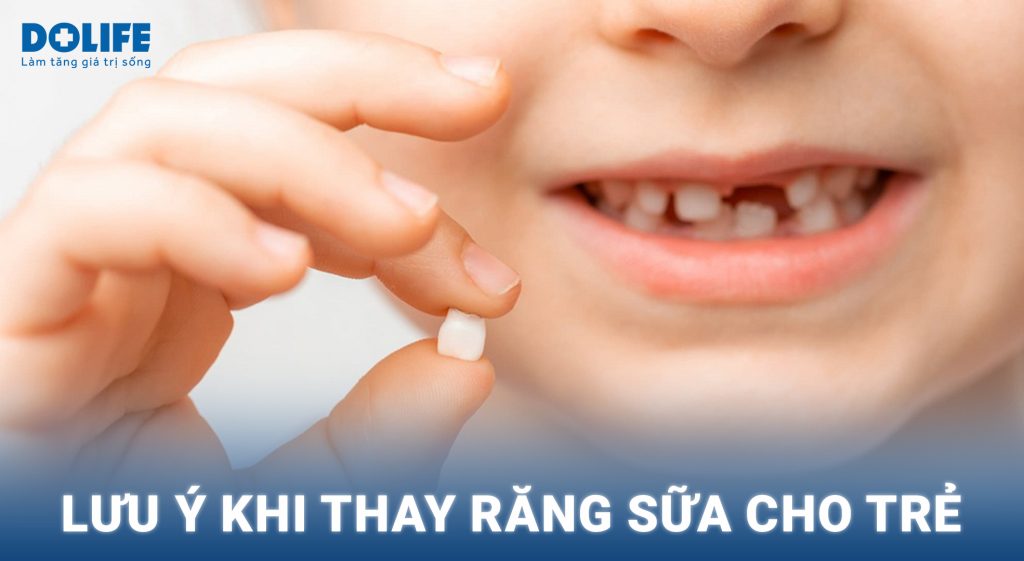 Lưu ý khi thay răng sữa cho trẻ – Hướng dẫn chăm sóc đúng cách