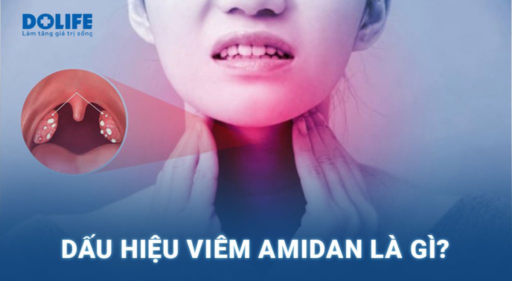 Viêm Amidan: Nguyên nhân, triệu chứng và cách điều trị