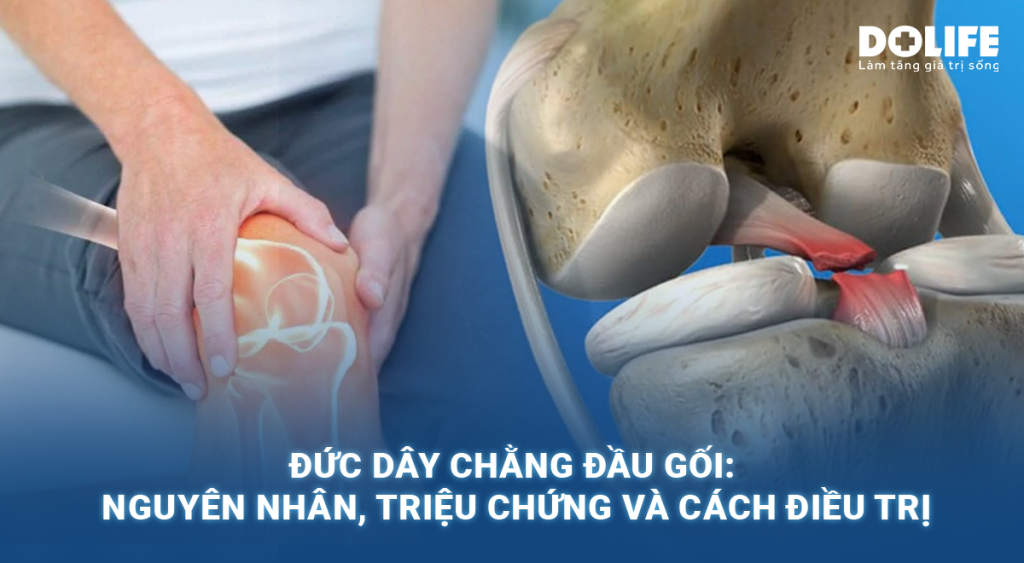 Đứt dây chằng đầu gối: Nguyên nhân, triệu chứng và phương pháp điều trị