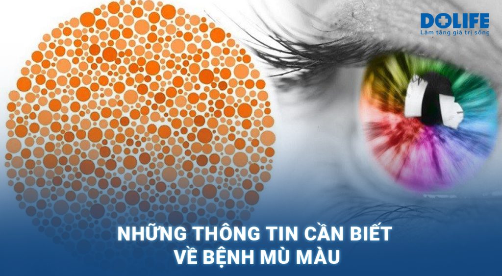 Mù màu: Những thông tin cần biết