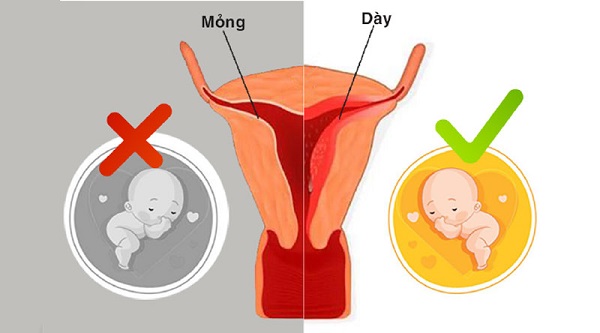 Niêm mạc tử cung mỏng có thai được không?