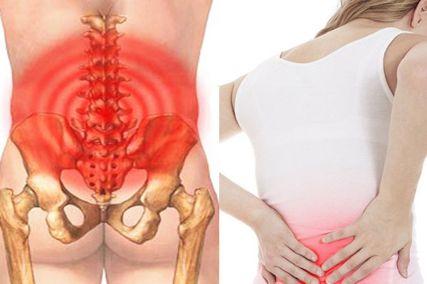 Đau thắt lưng sau sinh: Phát hiện tổn thương đĩa đệm cột sống ở phụ nữ 36 tuổi đang cho con bú