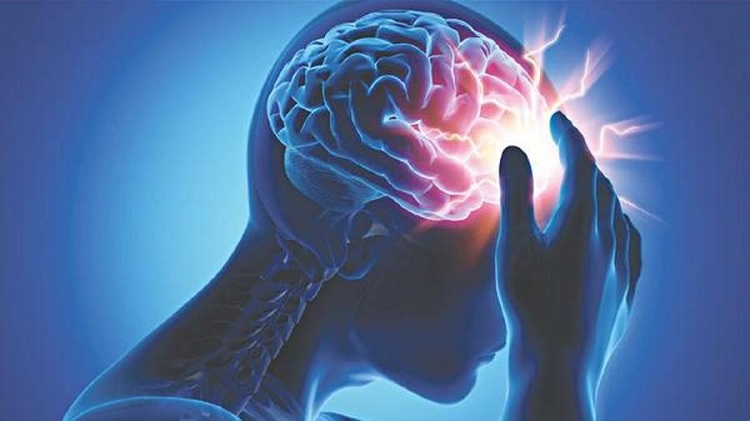 “Giờ vàng” đột quỵ – yếu tố quyết định cơ hội sống và phục hồi của người bệnh